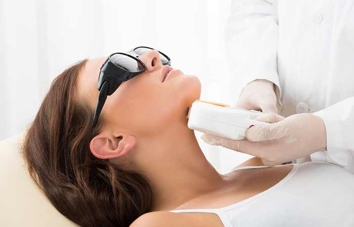 laser treatments